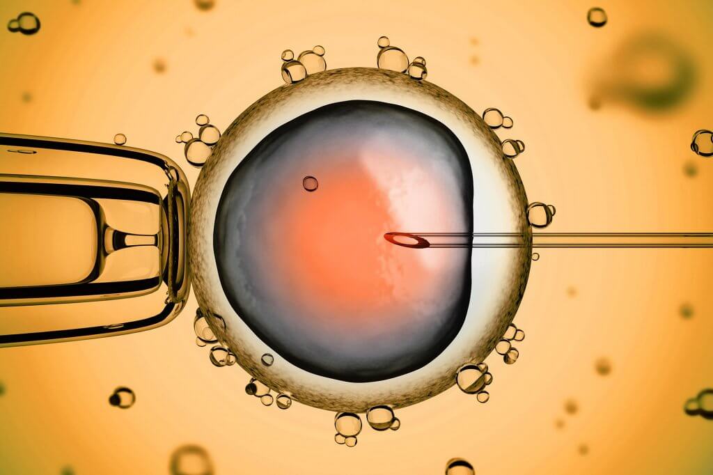 ICSI Embryotransfer